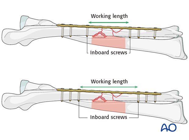 Working length considerations