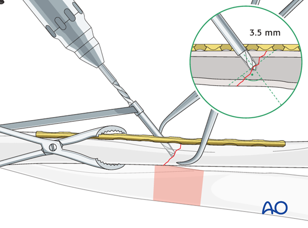 Drill gliding hole through plate