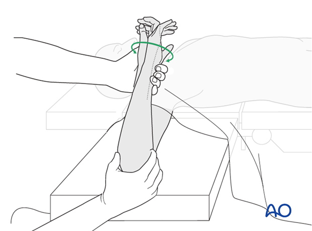 Check of osteosynthesis