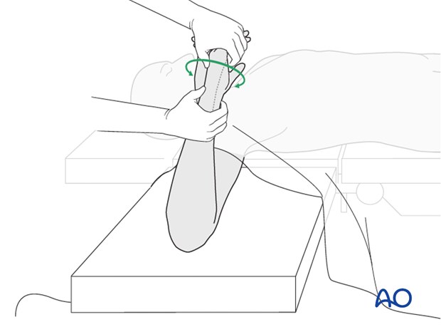 Check of osteosynthesis