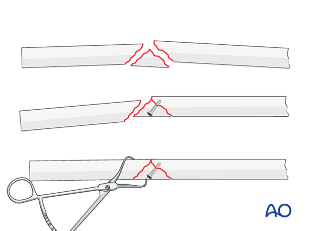 Wedge fragments