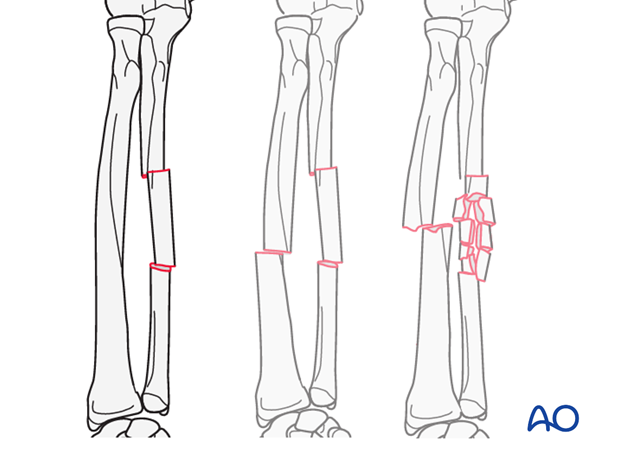 Detailed procedures