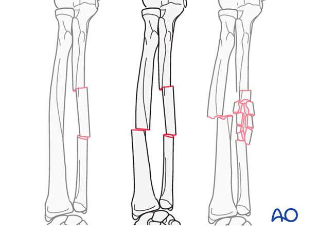 Detailed procedures