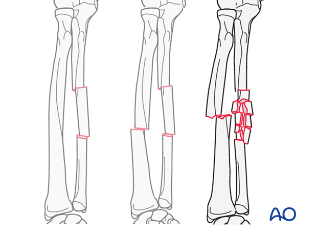 Detailed procedures