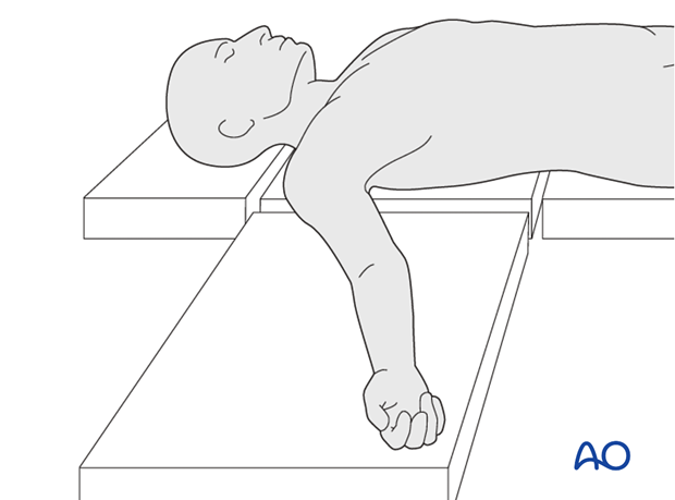 Preparation and positioning