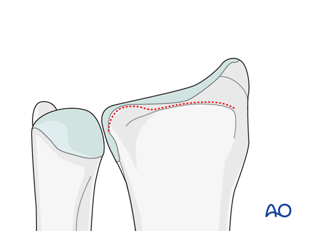 anatomy of the distal forearm