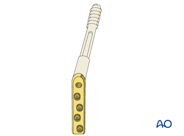 Sliding hip screws with a four-hole plate