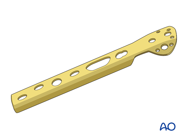 Trochanter stabilization plate (TSP)