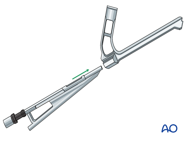 Assembling the insertion handle of the femoral neck system