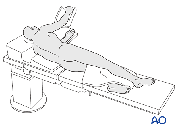 Patient in a lateral decubitus position for surgical treatment of proximal femoral fractures