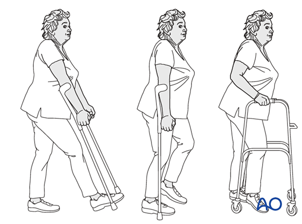 Weight bearing as tolerated with walking aids after treatment of proximal femoral fractures