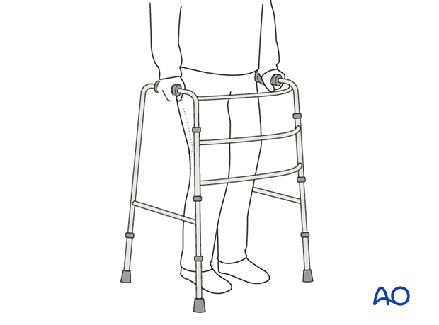 Weight bearing as tolerated with walking aids after treatment of proximal femoral fractures