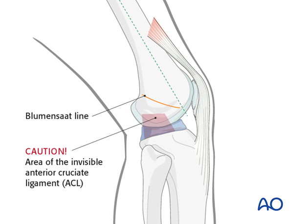 Anatomical landmarks