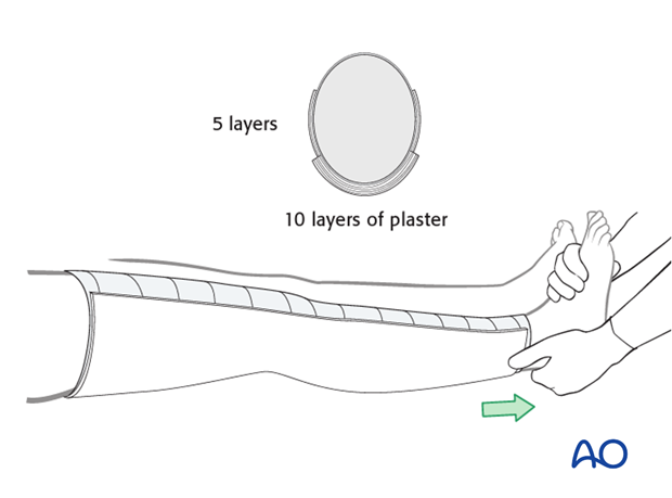 Application of plaster slabs