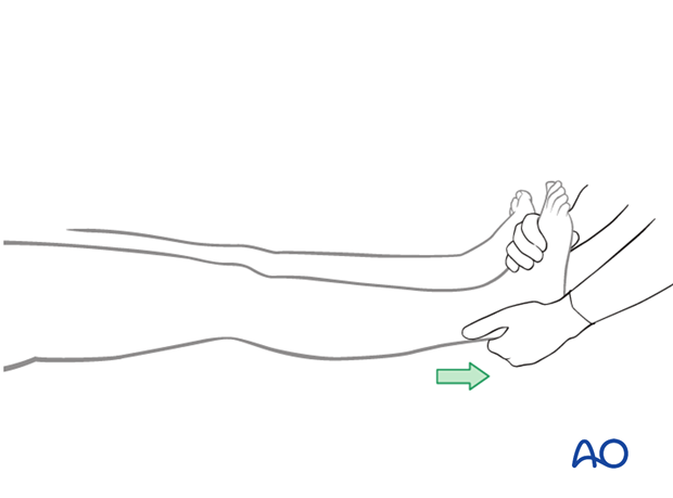 Establishment of length and rotation