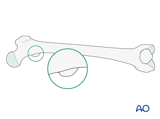 Assessment of rotation