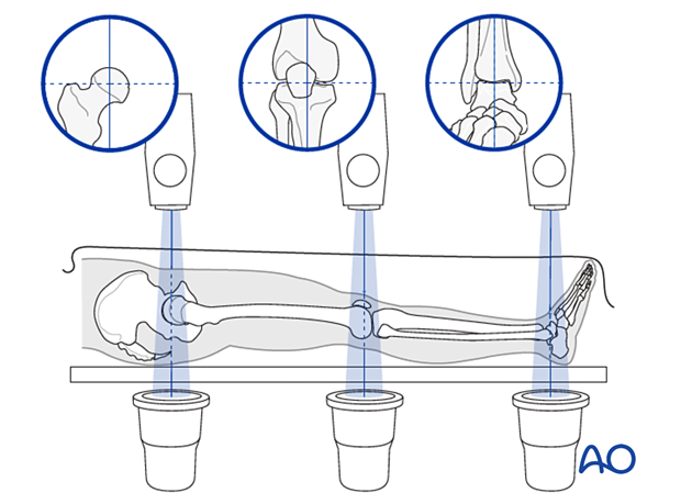 Verification of successful reduction, radiological lanmarks