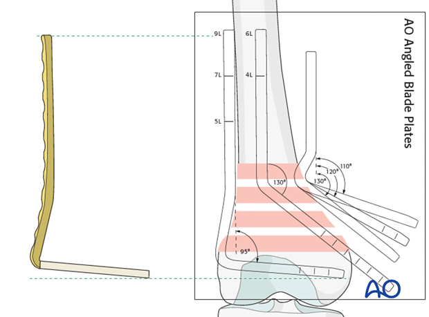 Plate length determination