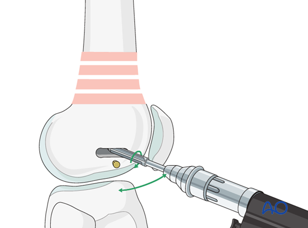 Connect the drill holes with a router