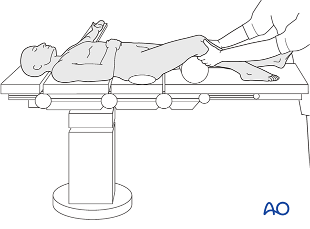 Manual reduction of metaphysis