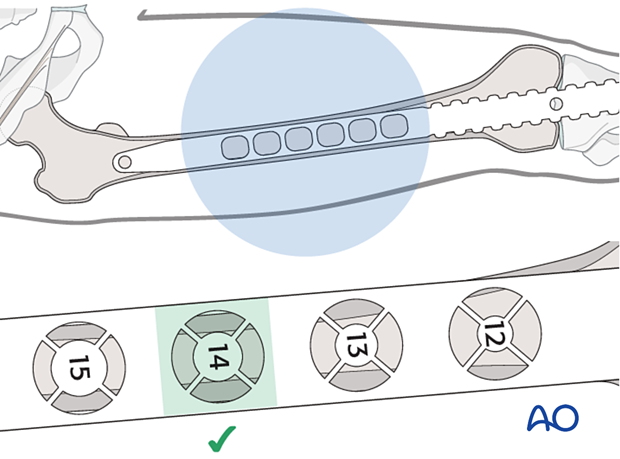 Determination of nail diameter