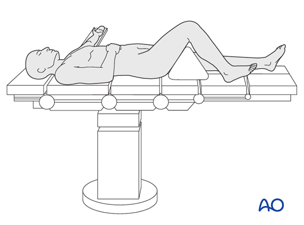 Patient and x-ray positioning 