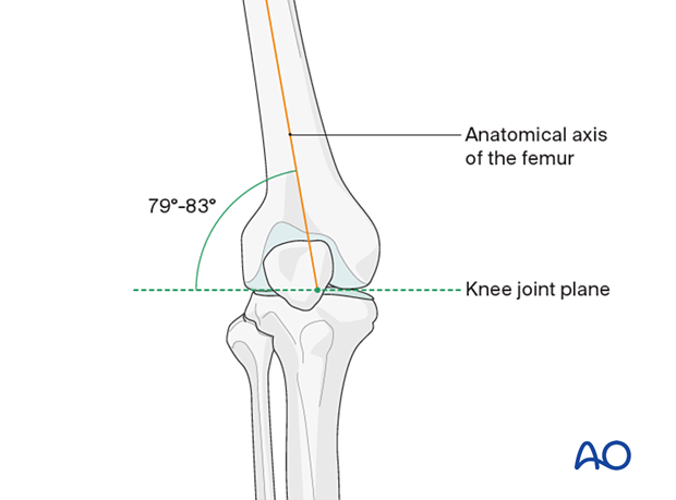 Anatomical axis of the femur