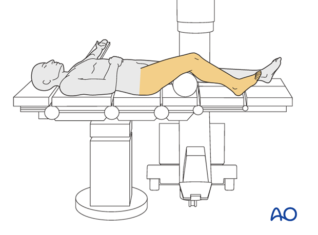 supine knee flexed 30