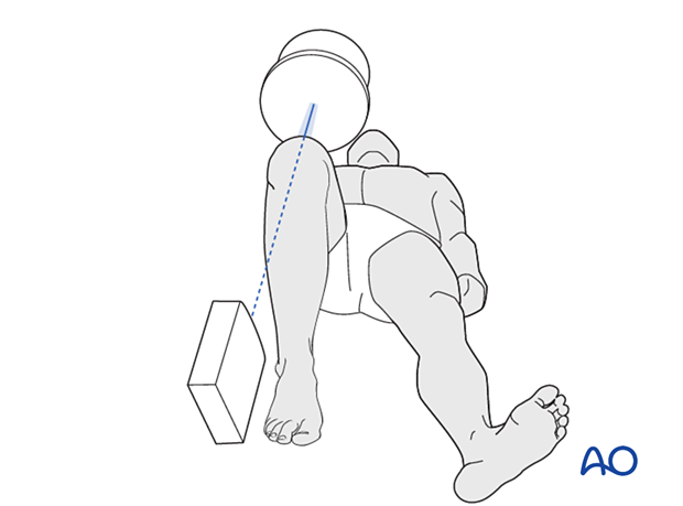 Positioning for optimal skyline view of the patella