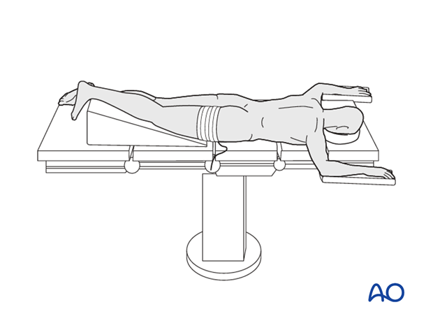 prone position