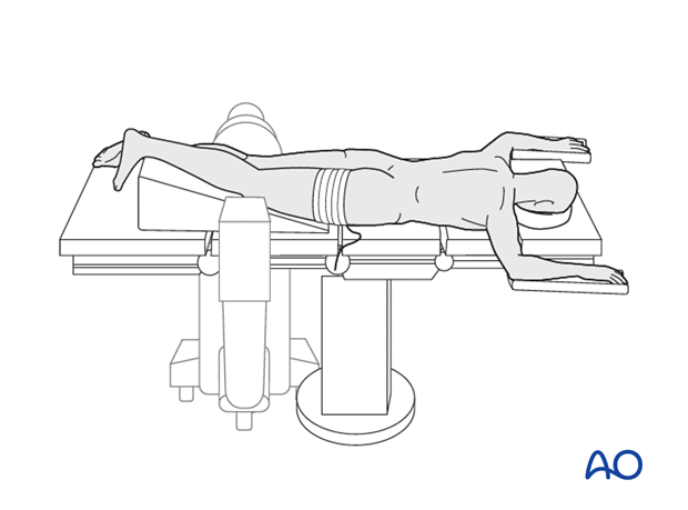 prone position