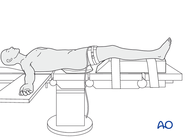 Supine position with tourniquet