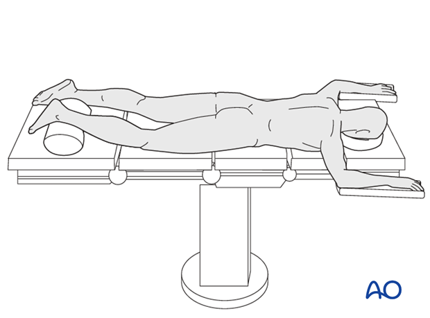 prone position