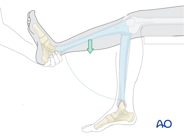 long leg circular cast