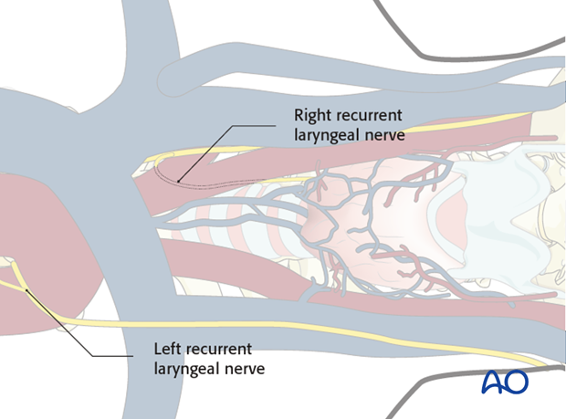 anterior access to c1t2