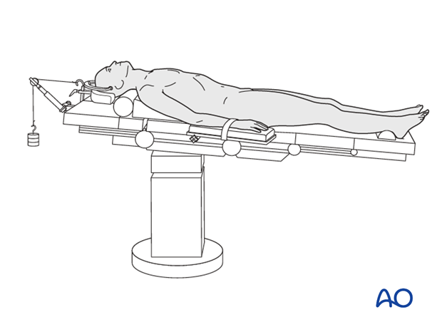 supine position