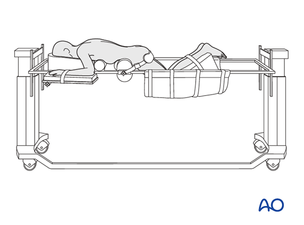 prone position