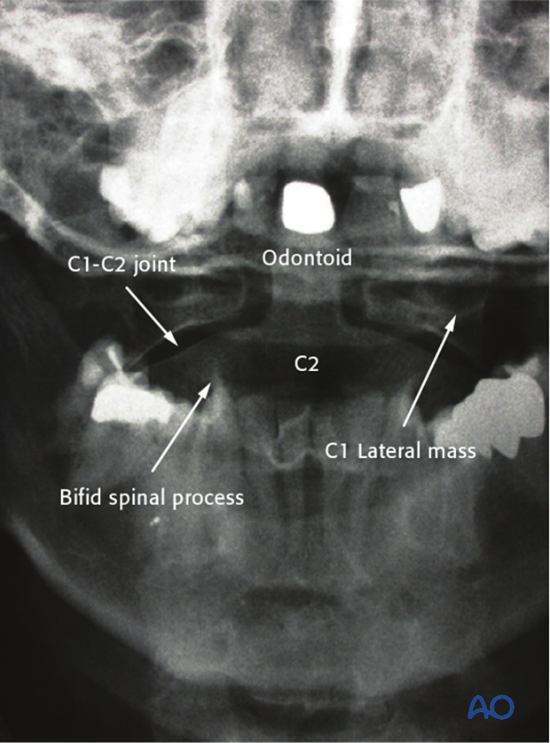 patient examination radiological evaluation xr ct mri