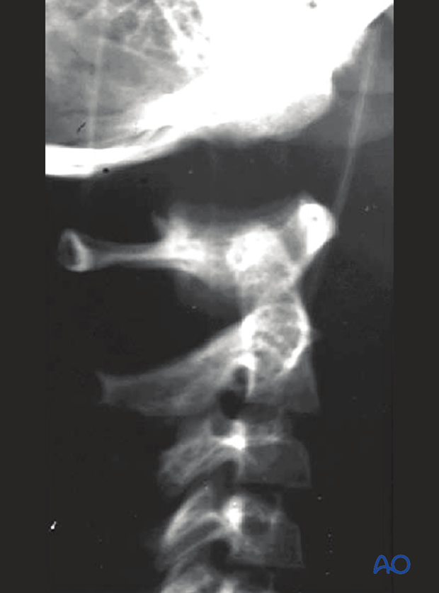 patient examination radiological evaluation xr ct mri