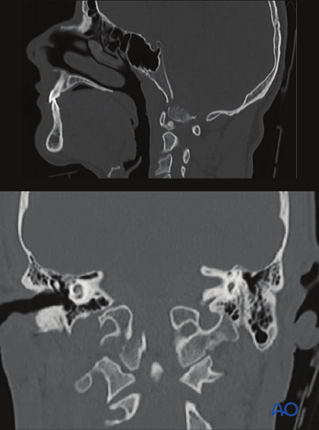 patient examination radiological evaluation xr ct mri