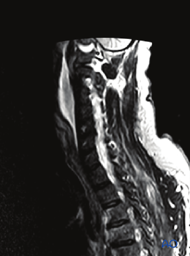 patient examination radiological evaluation xr ct mri