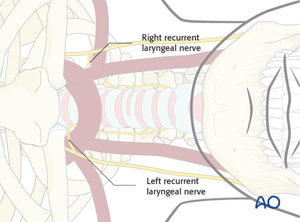 anterior approach to the cervical spine