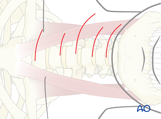 anterior approach to the cervical spine