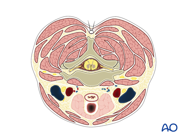 posterior approach to the cervical spine