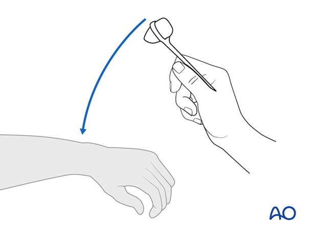 patient examination neurological evaluation