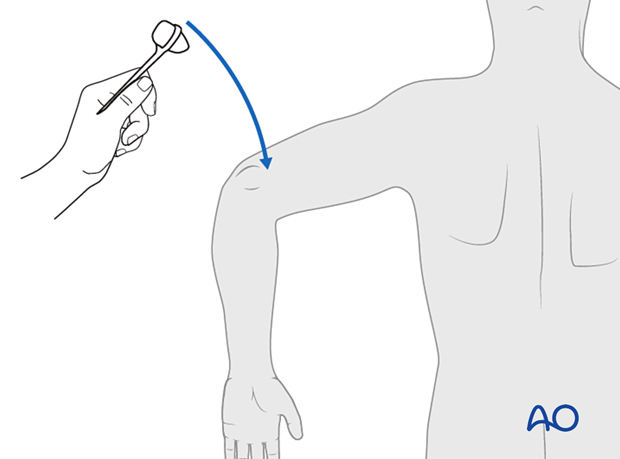 patient examination neurological evaluation