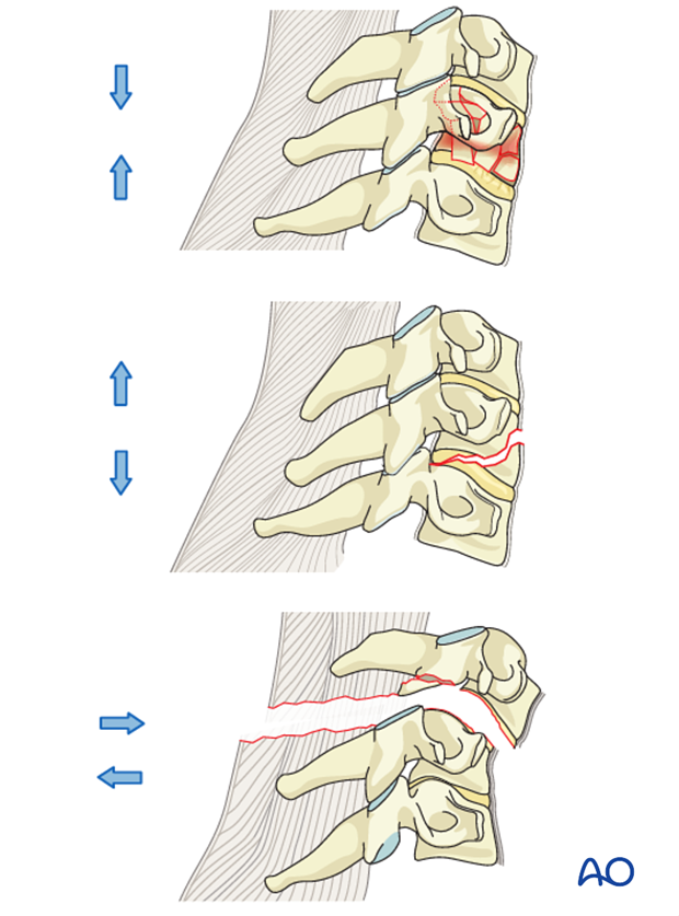 classification