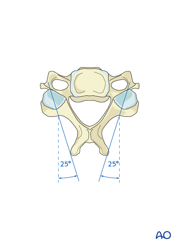 Medio-lateral angulation during the lateral mass screw insertion magerl technique