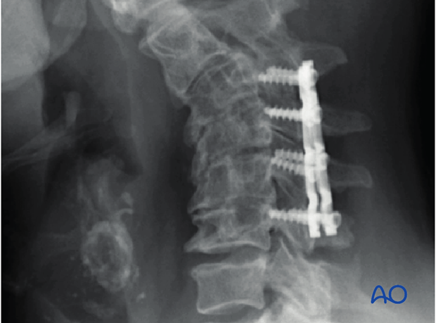 postoperative deformities