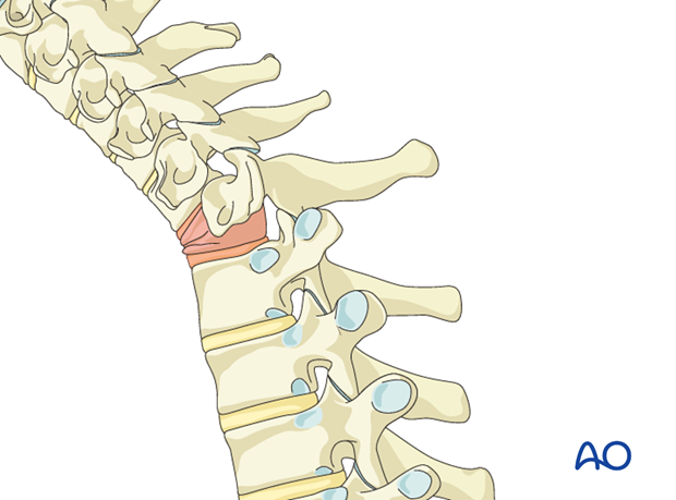 postoperative deformities